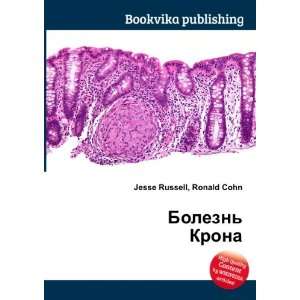  Bolezn Krona (in Russian language) Ronald Cohn Jesse 
