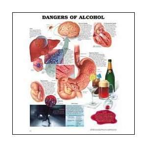  Dangers of Alcohol Anatomical Chart 20 X 26 Laminated 