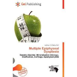   Epiphyseal Dysplasia (9786200799494) Iustinus Tim Avery Books