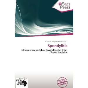    Spondylitis (9786138678700) Blossom Meghan Jessalyn Books