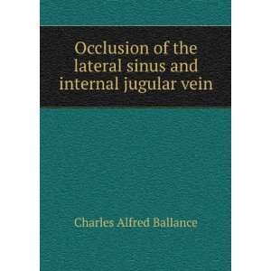   Sinus and Internal Jugular Vein Charles Alfred Ballance Books