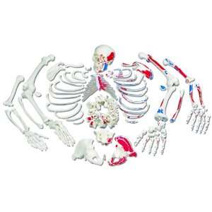 3B Scientific A05/2 Painted Muscles Disarticulated Full Human Skeleton 