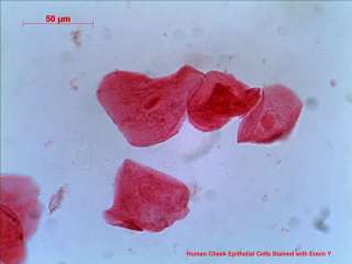 Figure 2. Human cheek epithelial cells stained with Eosin Y